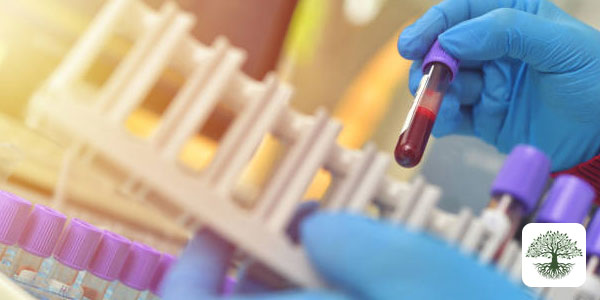 Anemi ve Demir Eksikliği: Hematolojik Hastalıklarda Fonksiyonel Tıp Yaklaşımı